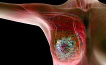 延长来曲唑治疗可以提高绝经后HR乳腺癌妇女的无病生存率