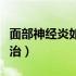 面部神经炎如何治疗效果好（面部神经炎如何治）