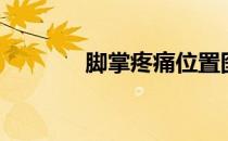脚掌疼痛位置图（脚掌疼痛）